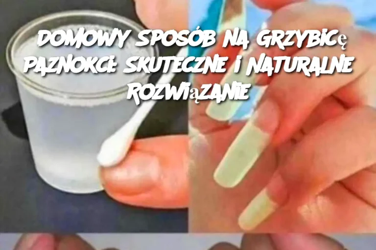 Domowy Sposób na Grzybicę Paznokci: Skuteczne i Naturalne Rozwiązanie